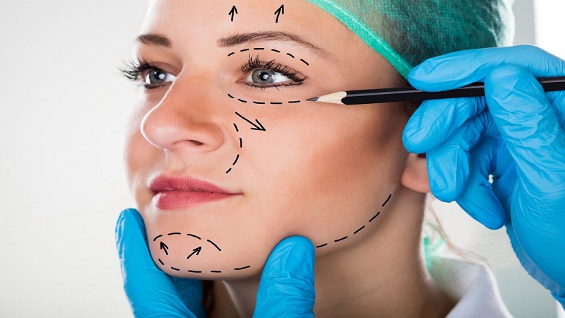 جراحی صورت 