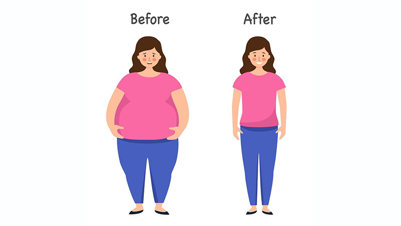 کاهش وزن بعد از لیپوماتیک