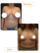 تصاویر قبل و بعد ماموپلاستی کاهشی