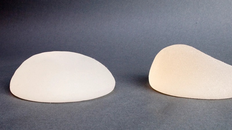 breast implant